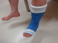 ギプスをしている写真