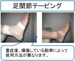 足関節テーピング